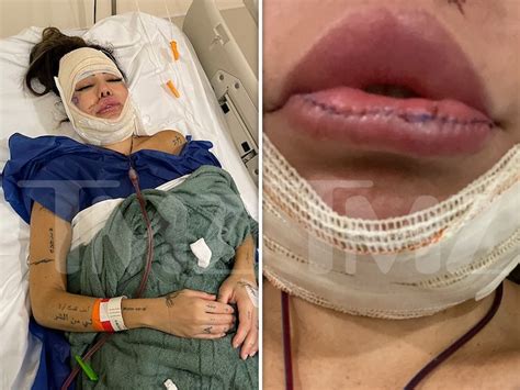 liziane gutierrez|Model Liziane Gutierrez Undergoes Emergency Surgery .